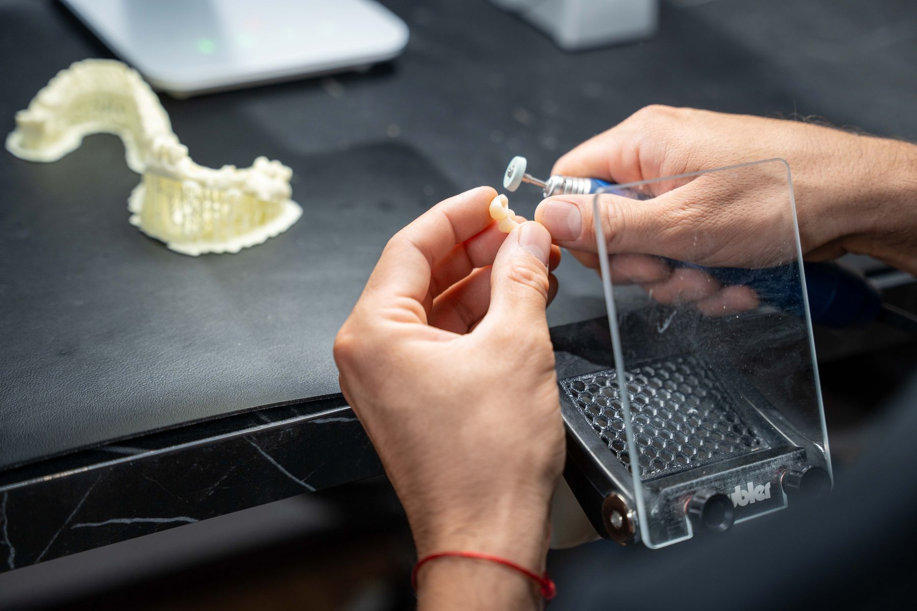 Nachbearbeitung einer 3D-gedruckten Implantatschablone im Dentallabor Norderstedt