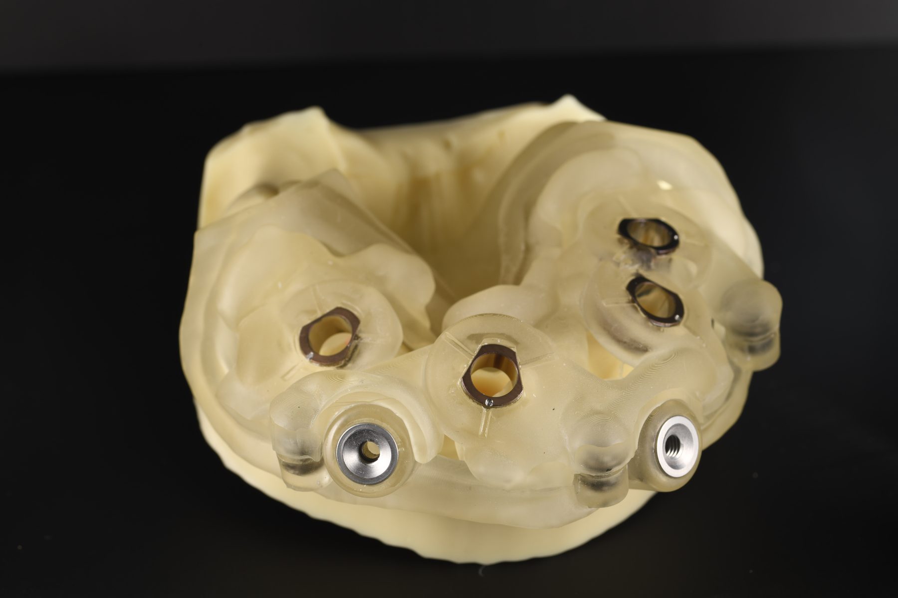 Gedruckte Implantatschablone auf dem Modell aus dem Dentallabor Holistic Smile Design