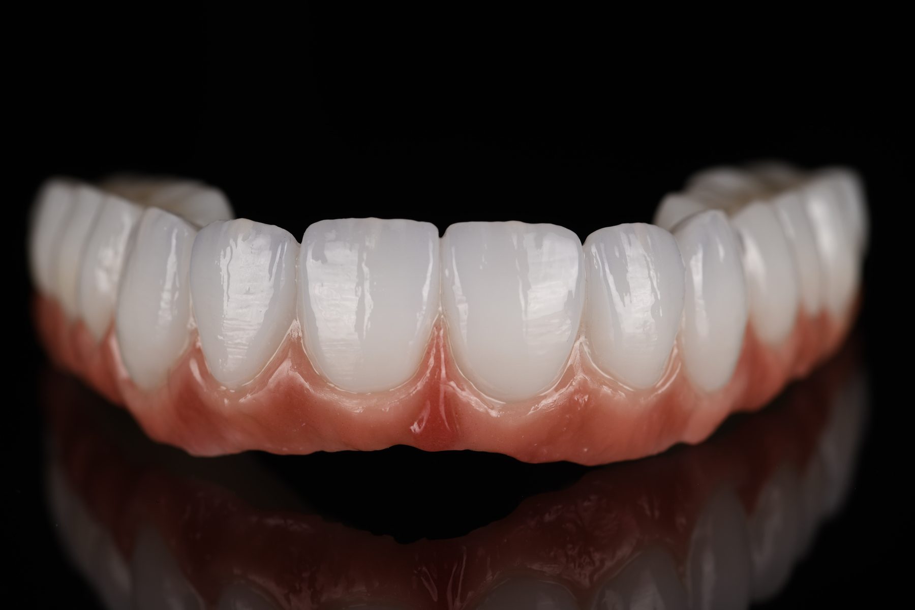 Vollkeramische Versorgung eines Zahnbogens aus dem Dentallabor Holistic Smile Design